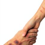 Ediciones ILCSA Psychology eBook Suicide OCD Spanish Edition-0